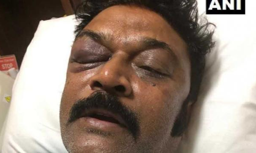 कर्नाटक कांग्रेस विधायक मारपीट: जेएन गणेश पार्टी से निलंबित, एफआईआर दर्ज कर्नाटक कांग्रेस विधायक मारपीट: जेएन गणेश पार्टी से निलंबित, एफआईआर दर्ज