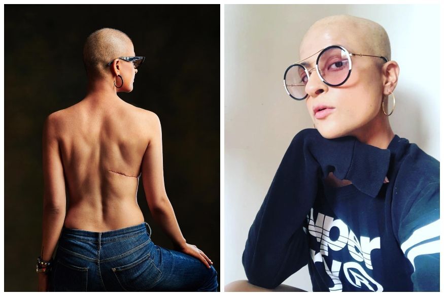 कैंसर से जंग लड़ रहीं आयुष्मान की पत्नी ने इस फोटो के साथ लिखा इमोशनल नोट, कैंसर वालों के लिए हैं प्रेरणा