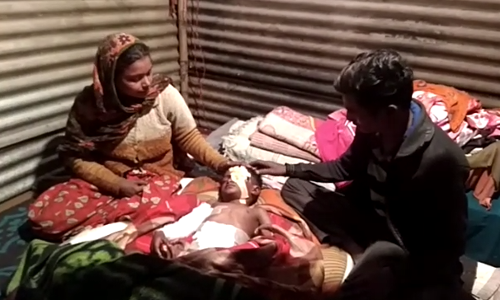 गाजियाबाद : आवारा कुत्तों ने सात साल के बच्चे को किया जख्मी