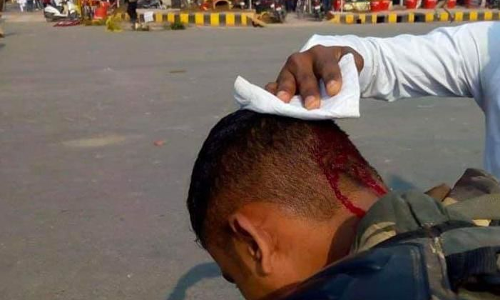 सांसद धर्मेंद्र के साथ इस आईपीएस अधिकारी के भी सर में लगी चोट सांसद धर्मेंद्र के साथ इस आईपीएस अधिकारी के भी सर में लगी चोट