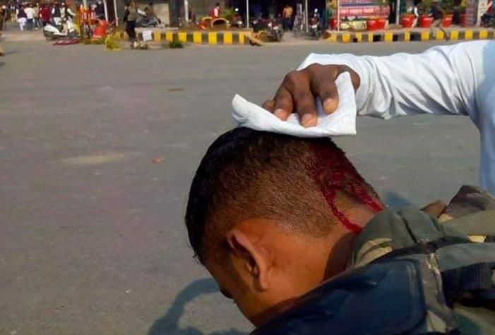सांसद धर्मेंद्र के साथ इस आईपीएस अधिकारी के भी सर में लगी चोट