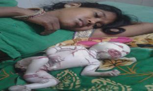 महिला ने ऐसे बच्चे को दिया जन्म, देखकर चौंक जाएंगे!