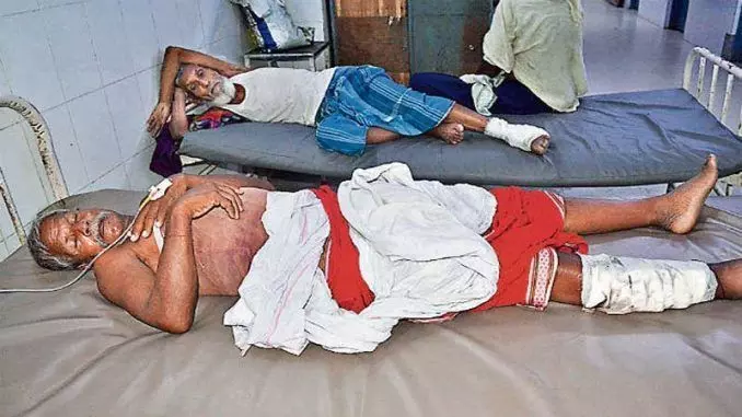 बिहार के गया में अस्पताल में आया अजीबोगरीब मामला सामने, करना था हाइड्रोसिल का ऑपरेशन लेकिन कर दिया दाएं पैर का बिहार के गया में अस्पताल में आया अजीबोगरीब मामला सामने, करना था हाइड्रोसिल का ऑपरेशन लेकिन कर दिया दाएं पैर का