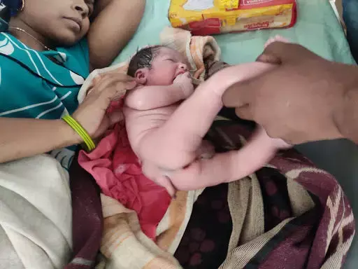 नोएडा में कुदरत का अजीबोगरीब करिश्मा, दो लिंग वाला बच्चा हुआ पैदा, देखने वालों की लगी भीड़
