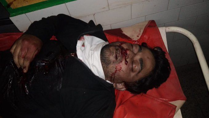कुछ इस तरह हुआ प्रेम कहानी का अंत, बिजनौर में ट्रिपल मर्डर के आरोपी जॉनी ने गोली मारकर खुदकुशी कर ली कुछ इस तरह हुआ प्रेम कहानी का अंत, बिजनौर में ट्रिपल मर्डर के आरोपी जॉनी ने गोली मारकर खुदकुशी कर ली
