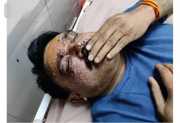 झाँसी में बदमाशों ने थानेदार को मारी गोली, एनकाउंटर में मारा गया आरोपी खनन माफिया