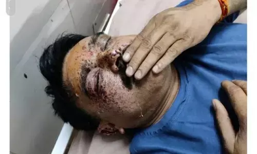 झाँसी में बदमाशों ने थानेदार को मारी गोली, एनकाउंटर में मारा गया आरोपी खनन माफिया झाँसी में बदमाशों ने थानेदार को मारी गोली, एनकाउंटर में मारा गया आरोपी खनन माफिया