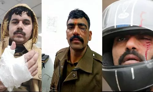 दिल्ली हिंसा में घायल पुलिस कर्मियों के फोटो कोई नहीं करेगा शेयर! दिल्ली हिंसा में घायल पुलिस कर्मियों के फोटो कोई नहीं करेगा शेयर!