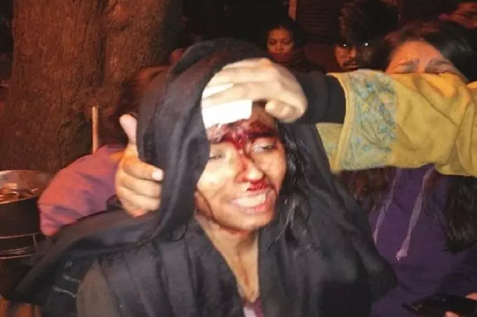 JNU Violence: हमले में घायल JNUSU अध्यक्ष आइशी घोष समेत इन 19 छात्रों के खिलाफ दिल्ली पुलिस ने दर्ज की FIR