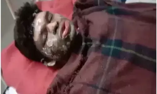 मध्यप्रदेश: सागर में जिंदा जलाए गए दलित युवक धनप्रसाद की इलाज के दौरान दिल्ली के सफदरजंग अस्पताल में मौत मध्यप्रदेश: सागर में जिंदा जलाए गए दलित युवक धनप्रसाद की इलाज के दौरान दिल्ली के सफदरजंग अस्पताल में मौत