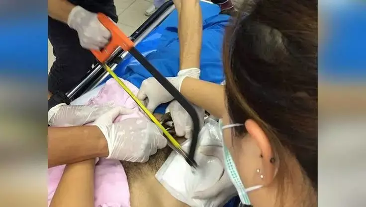 सेक्स की उत्तेजना में भूल गया सब कुछ, लेकिन जब दर्द हुआ तो चीख निकल गई और चिकित्सकों ने गैस कटर की मदद से बचाई जान