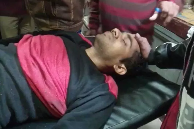 अयोध्या में बैंक ग्राहक सेवा केंद्र संचालक को गोली मार नगदी से भरा बैग लूटा अयोध्या में बैंक ग्राहक सेवा केंद्र संचालक को गोली मार नगदी से भरा बैग लूटा