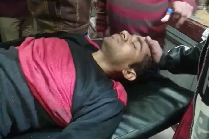 अयोध्या में बैंक ग्राहक सेवा केंद्र संचालक को गोली मार नगदी से भरा बैग लूटा