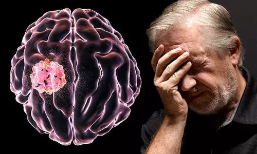 क्या आप जानते हैं ? ब्रेन ट्यूमर के ये हैं 7 संकेत