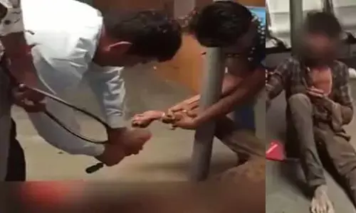 चोरी के आरोप में दलित युवक के प्राइवेट पार्ट में डाल दिया पेट्रोल से सना पेचकस, BJP ने कांग्रेस पर साधा निशाना