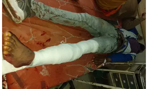 नोएडा में एक और मुठभेड़, लगातार हो रही मुठभेड़ से अपराधियों में पुलिस का खौफ नोएडा में एक और मुठभेड़, लगातार हो रही मुठभेड़ से अपराधियों में पुलिस का खौफ