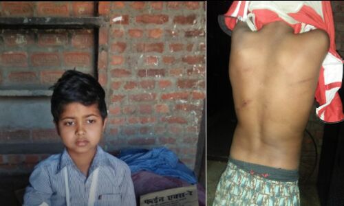 बहराइच : टीचर के मार से बच्चे का टूटा हाथ,शरीर पर चोट के निशान, अवैध छात्रावास में हो रहा बच्चों का उत्पीड़न,एक ही घर के थे दो बच्चे बहराइच : टीचर के मार से बच्चे का टूटा हाथ,शरीर पर चोट के निशान, अवैध छात्रावास में हो रहा बच्चों का उत्पीड़न,एक ही घर के थे दो बच्चे