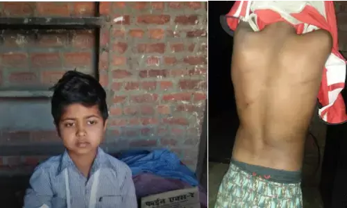 बहराइच : टीचर के मार से बच्चे का टूटा हाथ,शरीर पर चोट के निशान, अवैध छात्रावास में हो रहा बच्चों का उत्पीड़न,एक ही घर के थे दो बच्चे बहराइच : टीचर के मार से बच्चे का टूटा हाथ,शरीर पर चोट के निशान, अवैध छात्रावास में हो रहा बच्चों का उत्पीड़न,एक ही घर के थे दो बच्चे