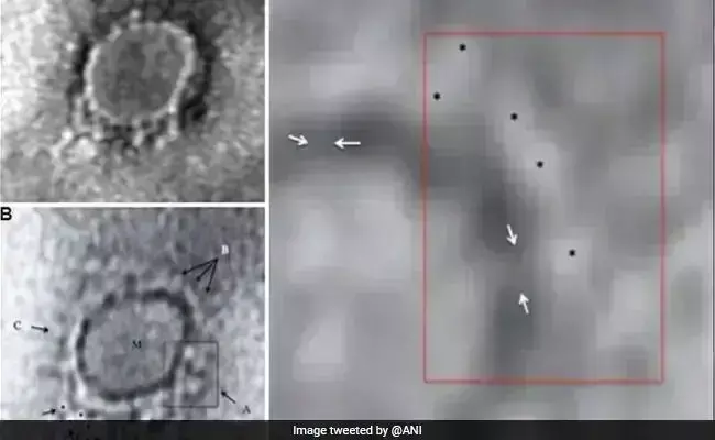 भारत में CoronaVirus की पहली तस्वीरें सामने आईं, देश के पहले मरीज से लिया गया था नमूना