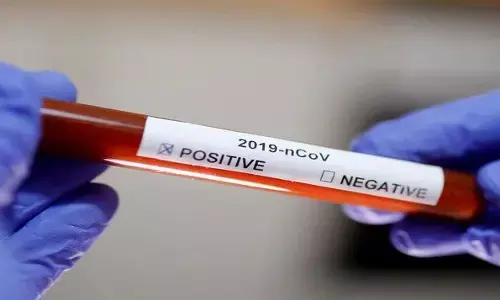 कोरोना की दहशत का गढ़ बना राजस्थान का भीलवाड़ा कोरोना की दहशत का गढ़ बना राजस्थान का भीलवाड़ा