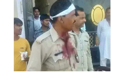 यूपी में नमाज पढ़ रहे तीस लोंगों ने पुलिस पर बोला हमला. दो सिपाही बुरी तरह घायल यूपी में नमाज पढ़ रहे तीस लोंगों ने पुलिस पर बोला हमला. दो सिपाही बुरी तरह घायल