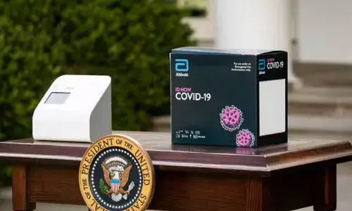 बड़ी खबर: आ जायेगी 5 मिनट में कोरोना संक्रमण की जांच करने वाली किट, जानिए कब तक! बड़ी खबर: आ जायेगी 5 मिनट में कोरोना संक्रमण की जांच करने वाली किट, जानिए कब तक!