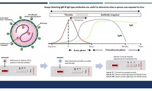 सबसे बड़ी खुश खबरी: कोविड-19 संक्रमण के परीक्षण के लिए विकसित की किट और वैक्सीन के उत्पादन की शुरू की तैयारी