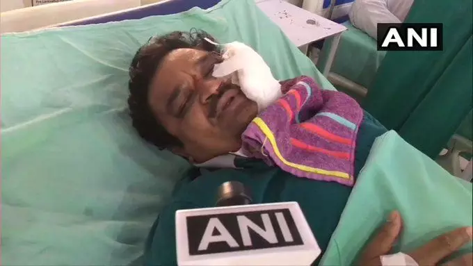 Corona virus update: कितनी बुरी तरह डॉ सुरेश चंद्र अग्रवाल को किया मुरादाबाद में घायल , देखिये पथराव का वीडियो