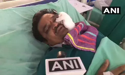 Corona virus update: कितनी बुरी तरह डॉ सुरेश चंद्र अग्रवाल को किया मुरादाबाद में घायल , देखिये पथराव का वीडियो Corona virus update: कितनी बुरी तरह डॉ सुरेश चंद्र अग्रवाल को किया मुरादाबाद में घायल , देखिये पथराव का वीडियो