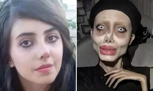 हॉलीवुड एक्‍ट्रेस जैसी दिखने के लिए युवती ने कराई थी 50 सर्जरी, अब जेल में हुआ कोरोना