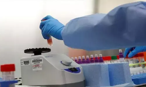 बिजनौर में मुंबई से लौटे पति-पत्नी समेत नौ लोग कोरोना वायरस से संक्रमित बिजनौर में मुंबई से लौटे पति-पत्नी समेत नौ लोग कोरोना वायरस से संक्रमित
