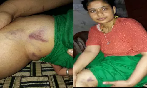 यूपी के गाजियाबाद में महिला आईएएस रानी नागर के सामने उसकी सगी बहन को बुरी तरह पीटा