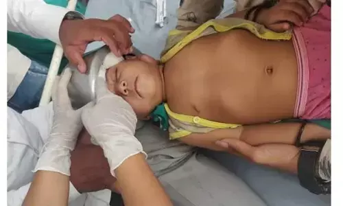 कुकर में फंस मासूम बच्चे का सिर, जब डॉक्टर भी हुए फेल तो ऐसे निकाला कुकर में फंस मासूम बच्चे का सिर, जब डॉक्टर भी हुए फेल तो ऐसे निकाला