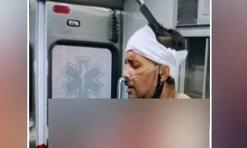 सिर में घुसे चाकू के साथ घूम रहा था शख्स, मदद के बजाय वीडियो बना रहे थे लोग सिर में घुसे चाकू के साथ घूम रहा था शख्स, मदद के बजाय वीडियो बना रहे थे लोग
