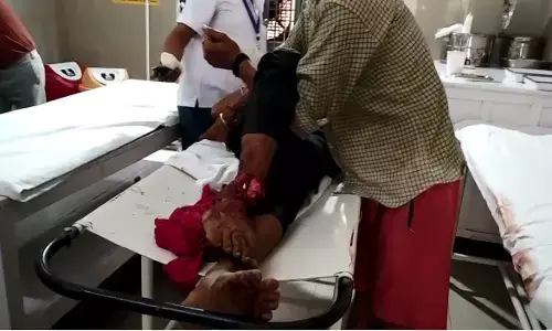 рд╢рд╛рдорд▓реА: рдЯреНрд░рдХ рдиреЗ рдпреБрд╡рдХ рдХреЛ рд░реМрдВрджрд╛, рдкреИрд░ рдЯреВрдЯрд╛ рд╢рд╛рдорд▓реА: рдЯреНрд░рдХ рдиреЗ рдпреБрд╡рдХ рдХреЛ рд░реМрдВрджрд╛, рдкреИрд░ рдЯреВрдЯрд╛