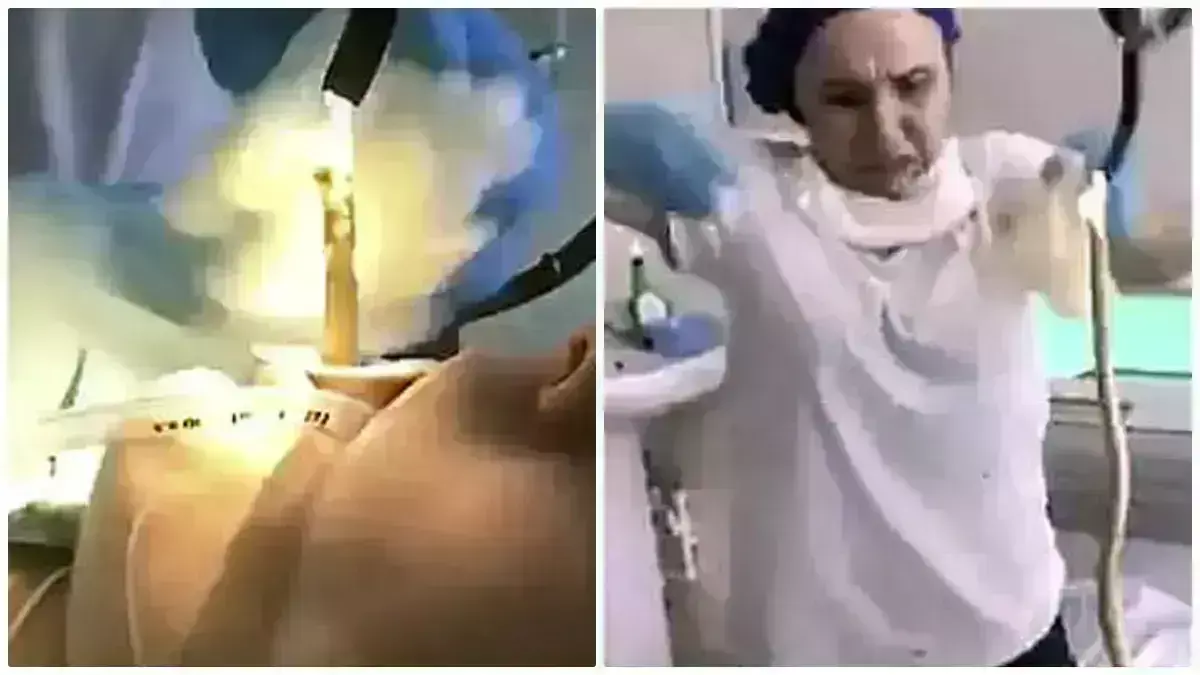 महिला के मुंह से 4 फीट लंबा सांप निकला, डॉक्टरों के छूटे पसीने महिला के मुंह से 4 फीट लंबा सांप निकला, डॉक्टरों के छूटे पसीने