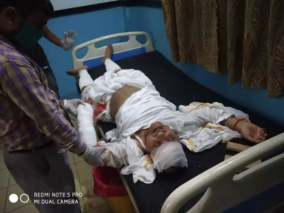 बीजेपी एमएलसी देवेंद्र सिंह का हुआ एक्सीडेंट, बुरी तरह से घायल एमएलसी को लखनऊ अस्पताल भेजा