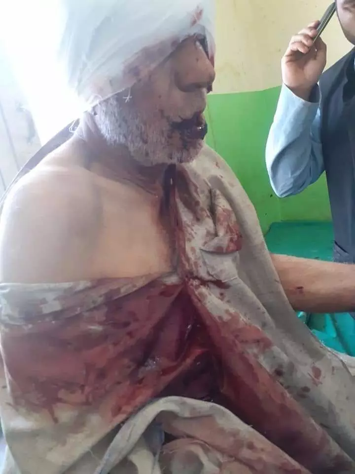 हंदवाड़ा में भालू के हमले में गंभीर रूप से घायल 65 वर्षीय व्यक्ति हंदवाड़ा में भालू के हमले में गंभीर रूप से घायल 65 वर्षीय व्यक्ति