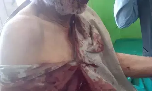 हंदवाड़ा में भालू के हमले में गंभीर रूप से घायल 65 वर्षीय व्यक्ति हंदवाड़ा में भालू के हमले में गंभीर रूप से घायल 65 वर्षीय व्यक्ति