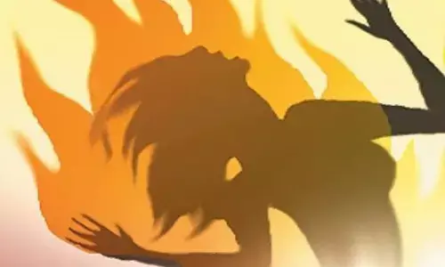 सीतापुर में जिंदा जलाई गई युवती की मौत, प्रेमी ने किया था आग के हवाले