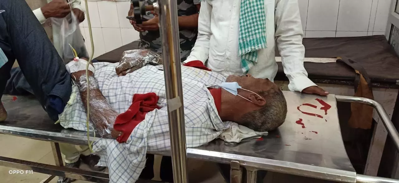 सुल्तानपुर में विद्युत् विभाग की बड़ी लापरवाही उजागर,शटडाउन मांगने के बाद खम्भे पर चढ़ा लाइन मैन करेंट से बुरी तरह झुलसा सुल्तानपुर में विद्युत् विभाग की बड़ी लापरवाही उजागर,शटडाउन मांगने के बाद खम्भे पर चढ़ा लाइन मैन करेंट से बुरी तरह झुलसा