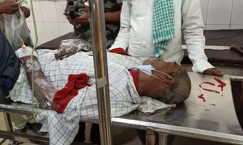 सुल्तानपुर में विद्युत् विभाग की बड़ी लापरवाही उजागर,शटडाउन मांगने के बाद खम्भे पर चढ़ा लाइन मैन करेंट से बुरी तरह झुलसा सुल्तानपुर में विद्युत् विभाग की बड़ी लापरवाही उजागर,शटडाउन मांगने के बाद खम्भे पर चढ़ा लाइन मैन करेंट से बुरी तरह झुलसा