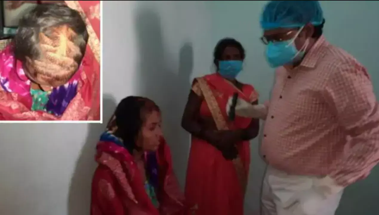 बिहार: प्रेमी की शादी से नाराज प्रेमिका ने दुल्हन को दी खौफनाक सजा, आंखों में डाला फेवीक्विक और... बिहार: प्रेमी की शादी से नाराज प्रेमिका ने दुल्हन को दी खौफनाक सजा, आंखों में डाला फेवीक्विक और...