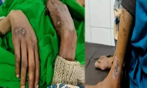 рджрд╣реЗрдЬ рдХреЗ рд▓рд╛рд▓рдЪреА рдкрддрд┐ рдХреНрд░реВрд░рддрд╛ рдХреА рд╕рд╛рд░реА рд╣рджреЗрдВ рдкрд╛рд░, рдкрддреНрдиреА рдХреЗ рдЦрд╛рдирд╛ рдорд╛рдВрдЧрдиреЗ рдкрд░ рдХреБрддреНрддреЗ рд╕реЗ рдХрдЯрд╡рд╛рдпрд╛! рджрд╣реЗрдЬ рдХреЗ рд▓рд╛рд▓рдЪреА рдкрддрд┐ рдХреНрд░реВрд░рддрд╛ рдХреА рд╕рд╛рд░реА рд╣рджреЗрдВ рдкрд╛рд░, рдкрддреНрдиреА рдХреЗ рдЦрд╛рдирд╛ рдорд╛рдВрдЧрдиреЗ рдкрд░ рдХреБрддреНрддреЗ рд╕реЗ рдХрдЯрд╡рд╛рдпрд╛!