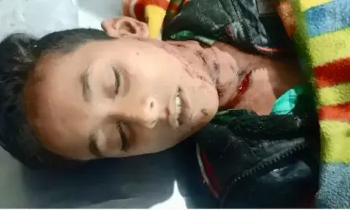 यूपी में गुलदार ने बच्चे को मार डाला यूपी में गुलदार ने बच्चे को मार डाला