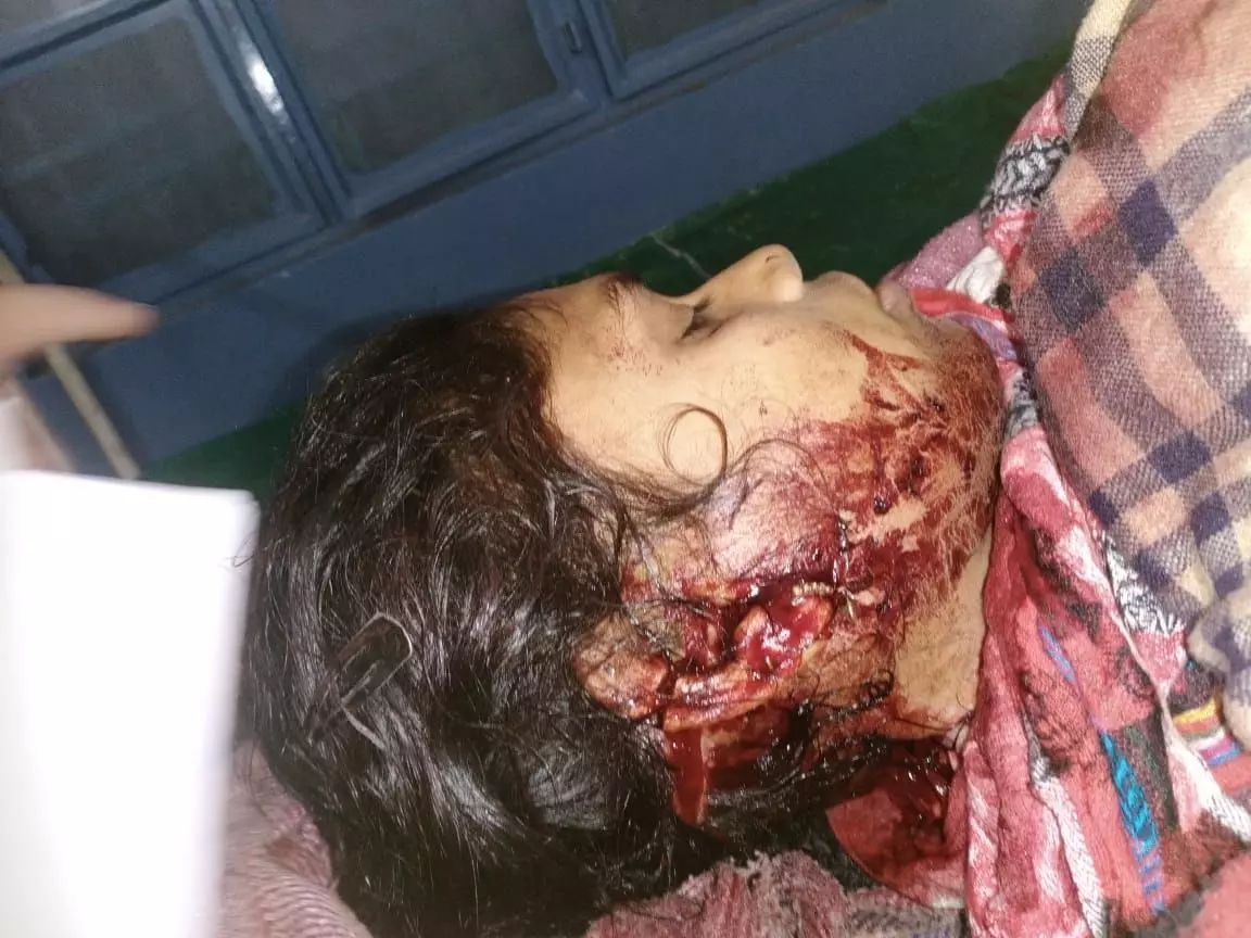 भतीजे ने चाची पर किया वार, मौके से पुलिस ने किया गिरफ्तार भतीजे ने चाची पर किया वार, मौके से पुलिस ने किया गिरफ्तार