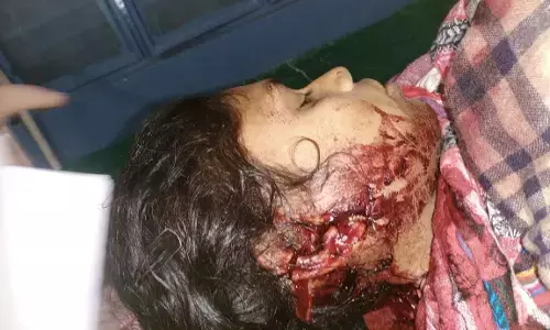 भतीजे ने चाची पर किया वार, मौके से पुलिस ने किया गिरफ्तार भतीजे ने चाची पर किया वार, मौके से पुलिस ने किया गिरफ्तार
