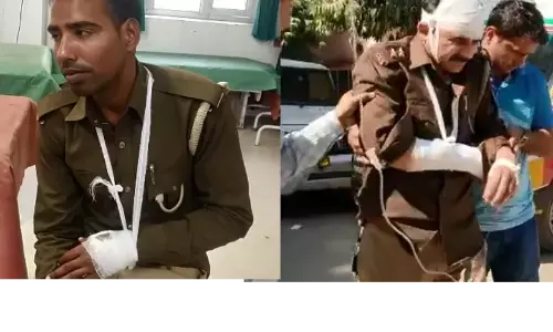 यूपी पुलिस पर बिजनौर में हुआ हमला, दरोगा समेत दो सिपाही घायल यूपी पुलिस पर बिजनौर में हुआ हमला, दरोगा समेत दो सिपाही घायल