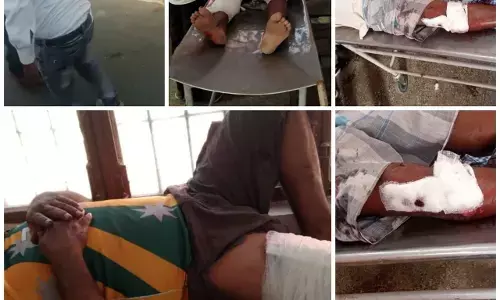 ट्रैक्टर की टक्कर से बाइक सवार घायल ट्रैक्टर की टक्कर से बाइक सवार घायल