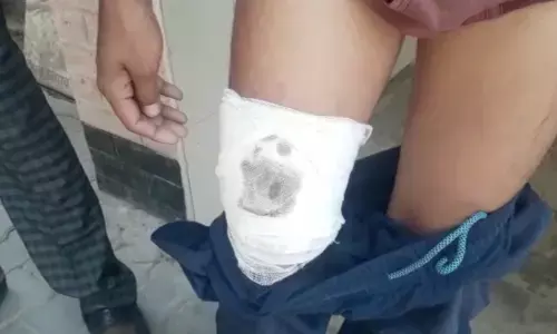 यूपी : कौशांबी में बीच बचाव करने में युवक को मारी गोली यूपी : कौशांबी में बीच बचाव करने में युवक को मारी गोली